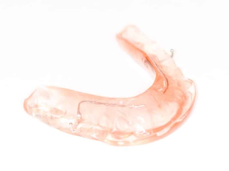 custom occlusal mouth guard