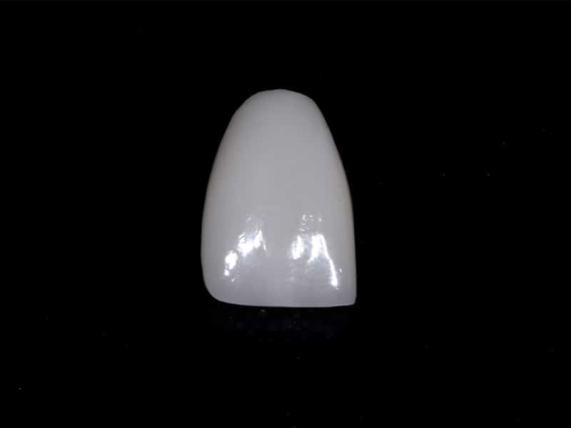 prepress veneers cosmetic dentistry services
